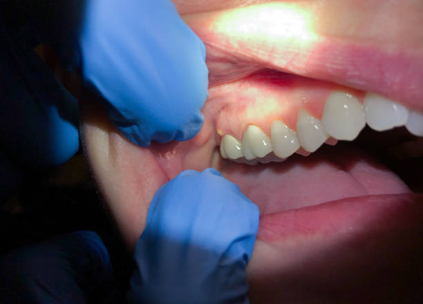 Best After-Hours Emergency Dentist in Richton Park, IL