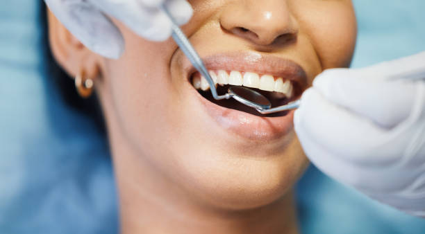 Best Emergency Broken Tooth Repair in Richton Park, IL